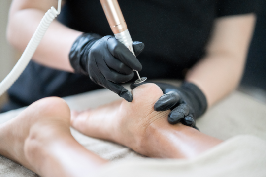 Soin anti-callosités